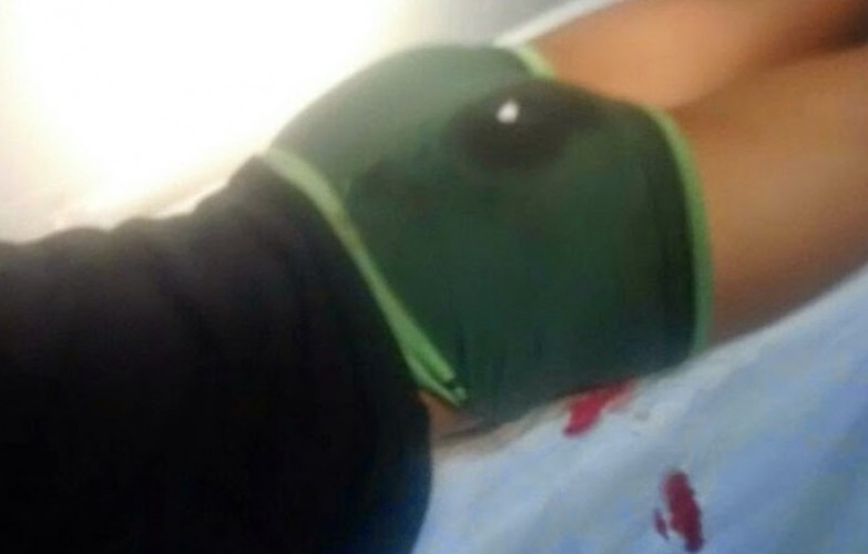 Bairro Aviso: mulher leva facada no bumbum do companheiro por causa de ciúmes