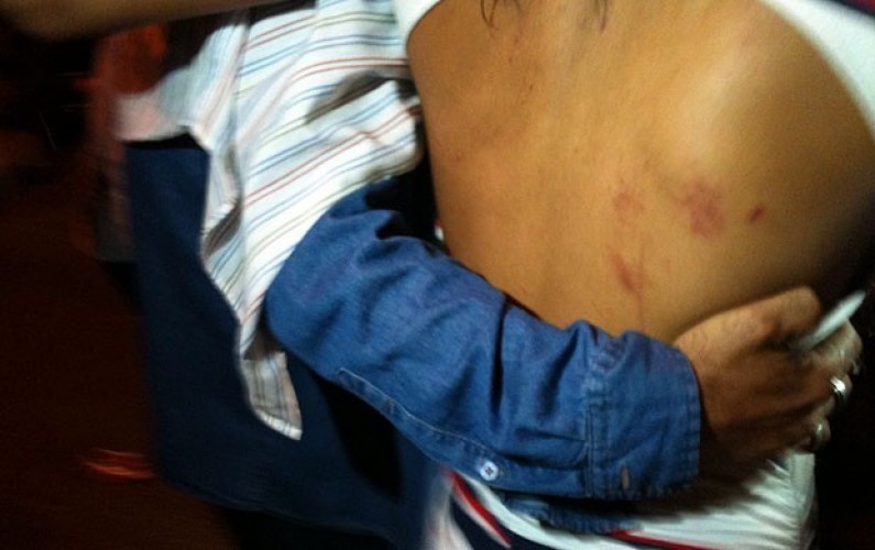 Estudante de 16 anos é marcada com ferro quente pelo namorado, de 23, no Interlagos