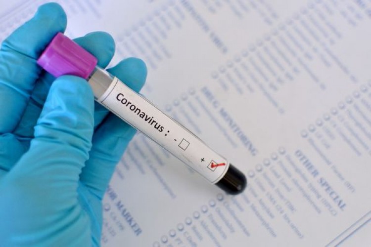 Coronavírus: Linhares tem 97 pacientes curados clinicamente e atinge 601 casos descartados