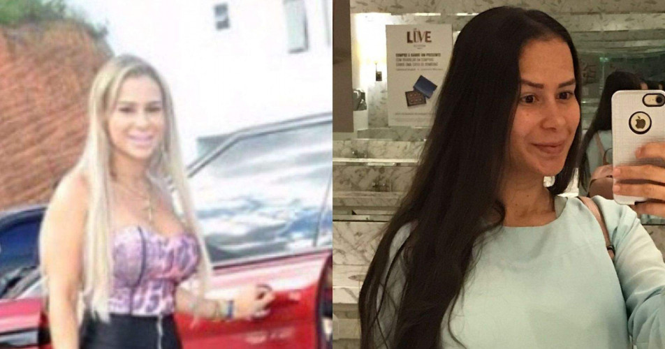 Ex-prostituta de luxo que atendia em Linhares faz vaquinha para tirar silicone: "Sinto dor"
