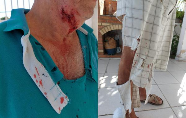 Idoso é atacado por dois cachorros durante caminhada no Novo Horizonte