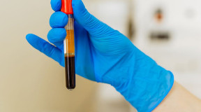 Linhares oferece novo teste para diagnosticar tuberculose latente