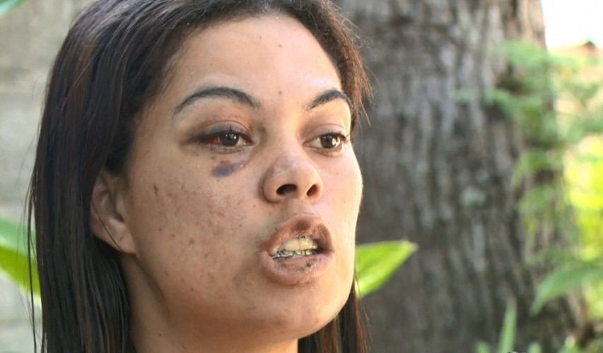 'Quase perdi a minha vida com medo de denunciar', diz diarista agredida por marido em Sooretama